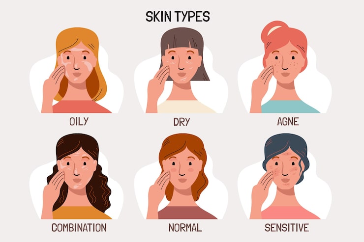 Illustration showing characteristics of different skin types